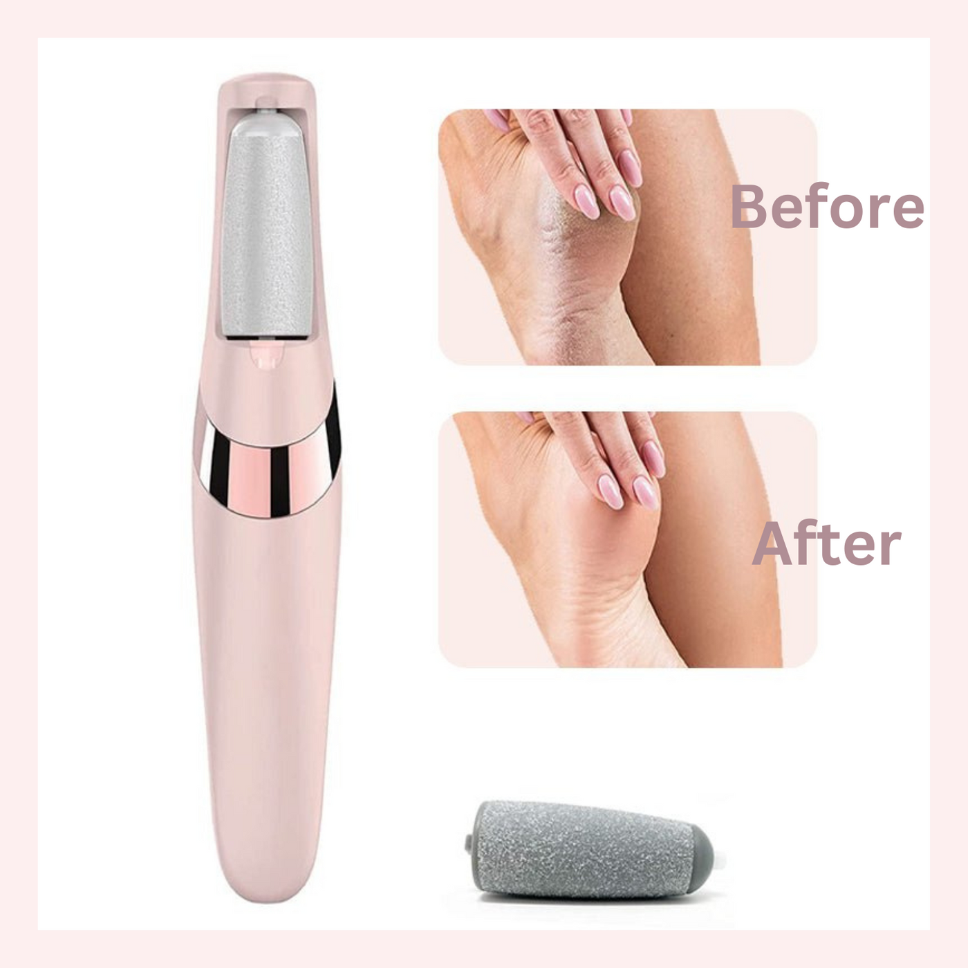 Electric Pedicure Foot File Callus Remover