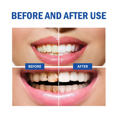 Sp-4 Probiotic Toothpaste | Make Your Teeth Shine